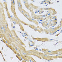 Immunohistochemistry of paraffin-embedded Mouse heart using SFRP4 Polyclonal Antibody at dilution of 1:100 (40x lens) .