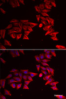 Immunofluorescence analysis of HeLa cells using SFRP4 Polyclonal Antibody