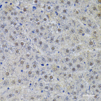 Immunohistochemistry of paraffin-embedded Rat liver using SNRPA Polyclonal Antibody at dilution of 1:100 (40x lens) .