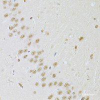 Immunohistochemistry of paraffin-embedded Rat brain using SNRPA Polyclonal Antibody at dilution of 1:100 (40x lens) .