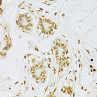 Immunohistochemistry of paraffin-embedded Human breast using SNRPA Polyclonal Antibody at dilution of 1:100 (40x lens) .