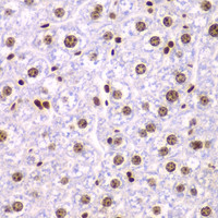 Immunohistochemistry of paraffin-embedded Mouse liver using SSRP1 Polyclonal Antibody at dilution of 1:200 (40x lens) .