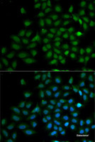 Immunofluorescence analysis of MCF7 cells using KLF10 Polyclonal Antibody