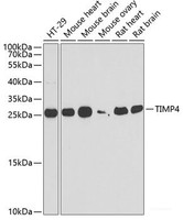 Western blot analysis of extracts of various cell lines using TIMP4 Polyclonal Antibody at dilution of 1:1000.