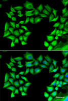 Immunofluorescence analysis of U2OS cells using TIMP4 Polyclonal Antibody