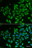 Immunofluorescence analysis of HeLa cells using CLEC3B Polyclonal Antibody