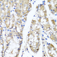 Immunohistochemistry of paraffin-embedded Human stomach using TNFAIP6 Polyclonal Antibody at dilution of 1:100 (40x lens) .