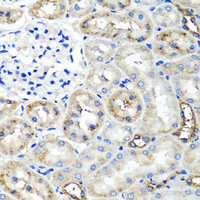 Immunohistochemistry of paraffin-embedded Rat kidney using TNFAIP6 Polyclonal Antibody at dilution of 1:100 (40x lens) .
