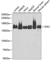 Western blot analysis of extracts of various cell lines using TPP2 Polyclonal Antibody at dilution of 1:1000.