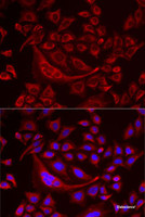 Immunofluorescence analysis of MCF7 cells using TUFM Polyclonal Antibody