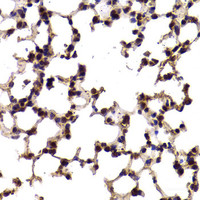 Immunohistochemistry of paraffin-embedded Mouse lung using SF1 Polyclonal Antibody at dilution of 1:100 (40x lens) .