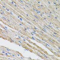 Immunohistochemistry of paraffin-embedded Mouse heart using MYOT Polyclonal Antibody at dilution of 1:100 (40x lens) .