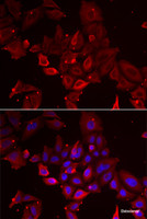 Immunofluorescence analysis of U2OS cells using MYOT Polyclonal Antibody
