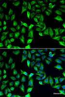 Immunofluorescence analysis of A549 cells using GDA Polyclonal Antibody