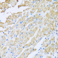 Immunohistochemistry of paraffin-embedded Mouse heart using IL18BP Polyclonal Antibody at dilution of 1:100 (40x lens) .