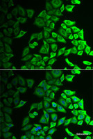 Immunofluorescence analysis of A549 cells using IL18BP Polyclonal Antibody