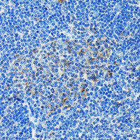 Immunohistochemistry of paraffin-embedded Rat spleen using PAICS Polyclonal Antibody at dilution of 1:100 (40x lens) .