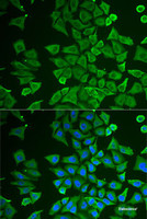 Immunofluorescence analysis of U2OS cells using DDAH2 Polyclonal Antibody