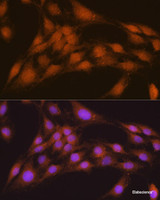 Immunofluorescence analysis of C6 cells using NRBF2 Polyclonal Antibody at dilution of 1:100. Blue: DAPI for nuclear staining.