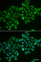 Immunofluorescence analysis of MCF-7 cells using RHOD Polyclonal Antibody