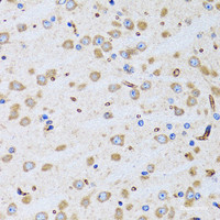 Immunohistochemistry of paraffin-embedded Rat brain using PTRH2 Polyclonal Antibody at dilution of 1:100 (40x lens) .