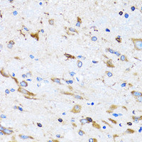 Immunohistochemistry of paraffin-embedded Mouse spinal cord using PTRH2 Polyclonal Antibody at dilution of 1:100 (40x lens) .