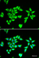 Immunofluorescence analysis of MCF-7 cells using PTRH2 Polyclonal Antibody