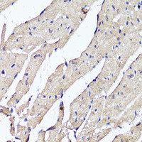 Immunohistochemistry of paraffin-embedded Mouse heart using ACSS2 Polyclonal Antibody at dilution of 1:100 (40x lens) .