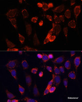 Immunofluorescence analysis of NIH/3T3 cells using ACSS2 Polyclonal Antibody at dilution of 1:100. Blue: DAPI for nuclear staining.