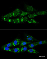 Confocal immunofluorescence analysis of NIH-3T3 cells using ACSS2 Polyclonal Antibody at dilution of 1:200. Blue: DAPI for nuclear staining.