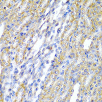 Immunohistochemistry of paraffin-embedded Rat kidney using CYP20A1 Polyclonal Antibody at dilution of 1:200 (40x lens) .