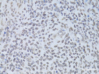 Immunohistochemistry of paraffin-embedded Human adenomyosis using LMNB2 Polyclonal Antibody at dilution of 1:100 (40x lens) .