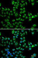 Immunofluorescence analysis of U2OS cells using LMNB2 Polyclonal Antibody