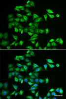 Immunofluorescence analysis of A549 cells using POMGNT2 Polyclonal Antibody