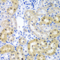 Immunohistochemistry of paraffin-embedded Rat kidney using ADAD1 Polyclonal Antibody at dilution of 1:200 (40x lens) .