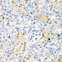 Immunohistochemistry of paraffin-embedded Mouse kidney using ADAD1 Polyclonal Antibody at dilution of 1:200 (40x lens) .