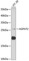 Western blot analysis of extracts of HT-29 cells using AGPAT2 Polyclonal Antibody at dilution of 1:1000.