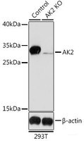 Western blot analysis of extracts from normal (control) and AK2 knockout (KO) 293T cells using AK2 Polyclonal Antibody at dilution of 1:1000.