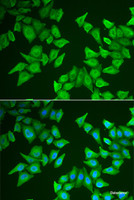 Immunofluorescence analysis of HeLa cells using ALAS2 Polyclonal Antibody