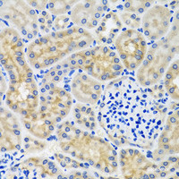 Immunohistochemistry of paraffin-embedded Mouse kidney using ANTXR2 Polyclonal Antibody at dilution of 1:100 (40x lens) .