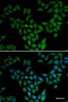 Immunofluorescence analysis of HeLa cells using ASF1A Polyclonal Antibody
