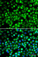 Immunofluorescence analysis of HeLa cells using ATP6AP2 Polyclonal Antibody