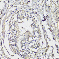 Immunohistochemistry of paraffin-embedded Human breast using BAP1 Polyclonal Antibody at dilution of 1:150 (40x lens) .