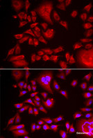 Immunofluorescence analysis of HeLa cells using BLMH Polyclonal Antibody