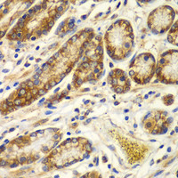 Immunohistochemistry of paraffin-embedded Human colon using CAPNS1 Polyclonal Antibody at dilution of 1:100 (40x lens) .