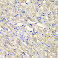 Immunohistochemistry of paraffin-embedded Mouse heart using CARS Polyclonal Antibody at dilution of 1:100 (40x lens) .