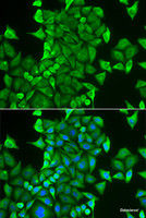 Immunofluorescence analysis of HeLa cells using CARS Polyclonal Antibody