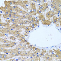 Immunohistochemistry of paraffin-embedded Human liver using CCM2 Polyclonal Antibody at dilution of 1:100 (40x lens) .