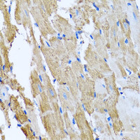 Immunohistochemistry of paraffin-embedded Rat heart using CCM2 Polyclonal Antibody at dilution of 1:100 (40x lens) .