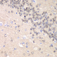 Immunohistochemistry of paraffin-embedded Rat brain using CCNC Polyclonal Antibody at dilution of 1:100 (40x lens) .